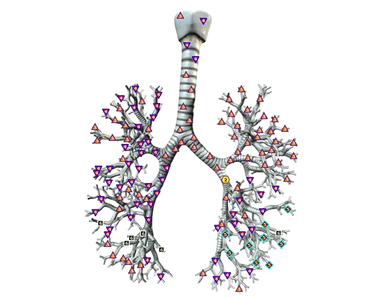 Trachea and bronchi 1