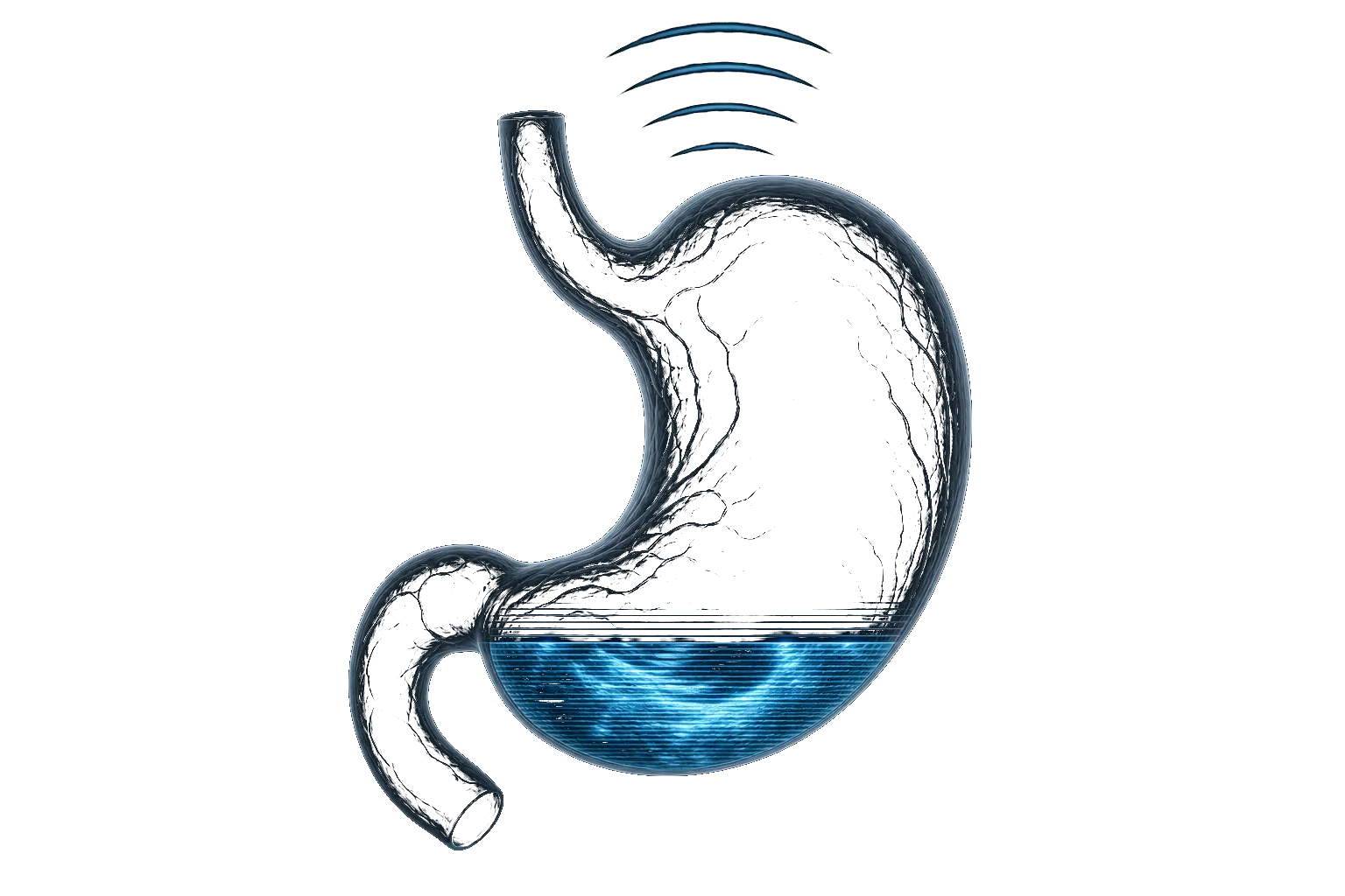 Ultrasonography