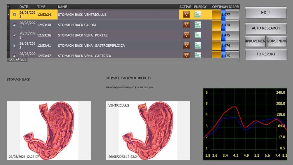 Advanced Health Diagnostic and Treatment Kit: ISHA Hunter Metatron Pro/Virus Expert/DNA Expert/Aura Expert/Meta Human 5000+, Hardware NLS Diamond Device, Bioinductor Headphones with 4 Sensors, and Reprint Chamber - Image 4